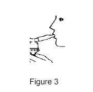 Albuterol Sulfate