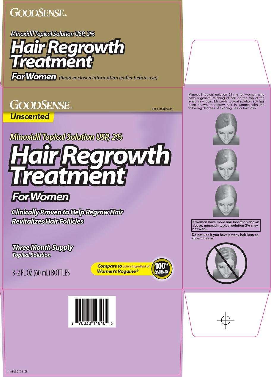 Good Sense hair regrowth treatment