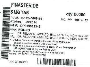 Finasteride