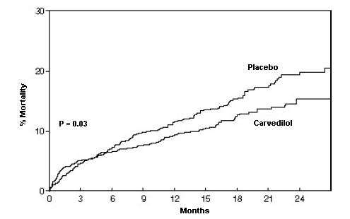 Carvedilol
