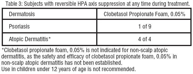 Clobetasol Propionate