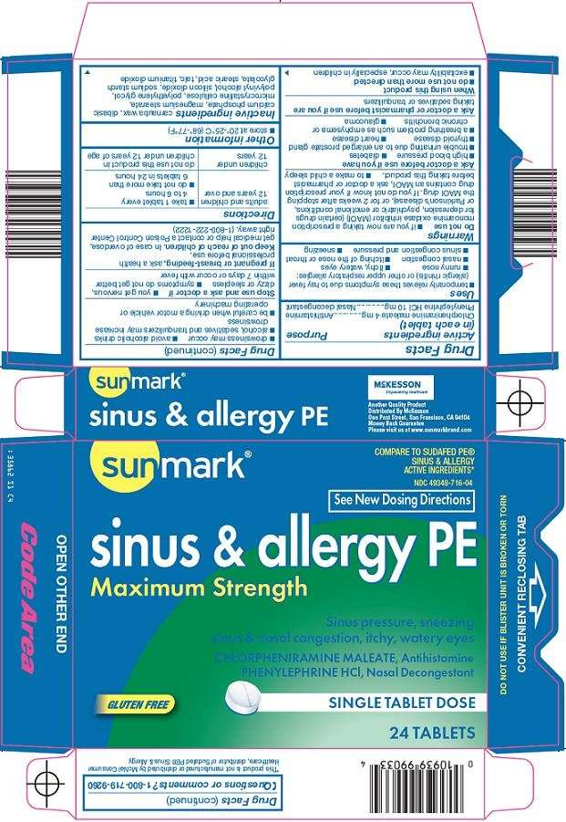 sunmark sinus and allergy pe