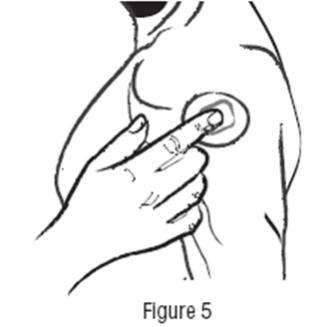 Clonidine transdermal system