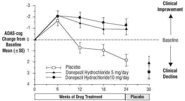 Donepezil Hydrochloride