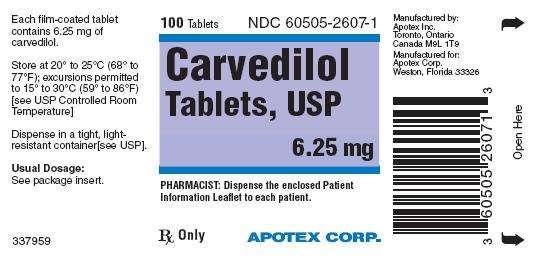 Carvedilol