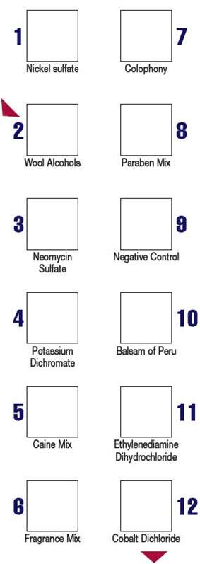 T.R.U.E. Test