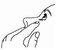 dorzolamide hydrochloride-timolol maleate