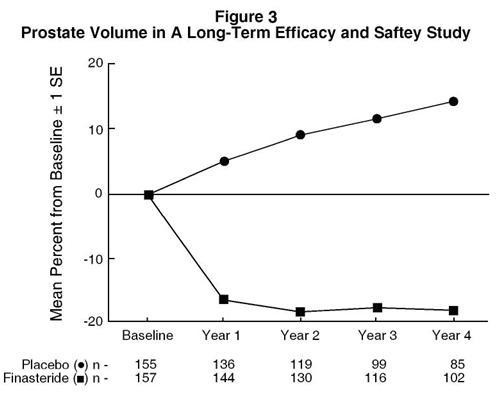 Finasteride