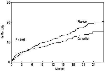 carvedilol