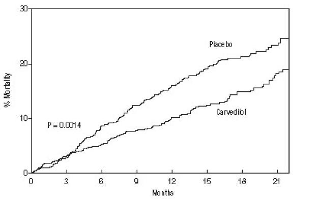 Carvedilol