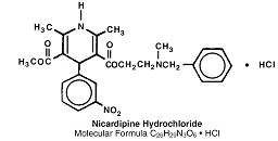 Nicardipine Hydrochloride