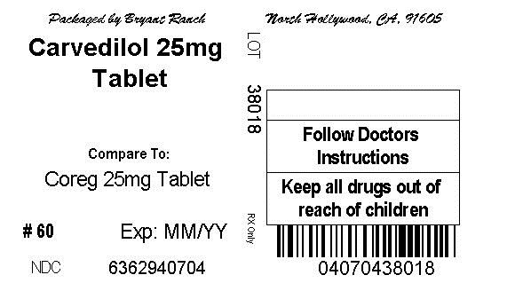 Carvedilol