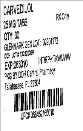 Carvedilol