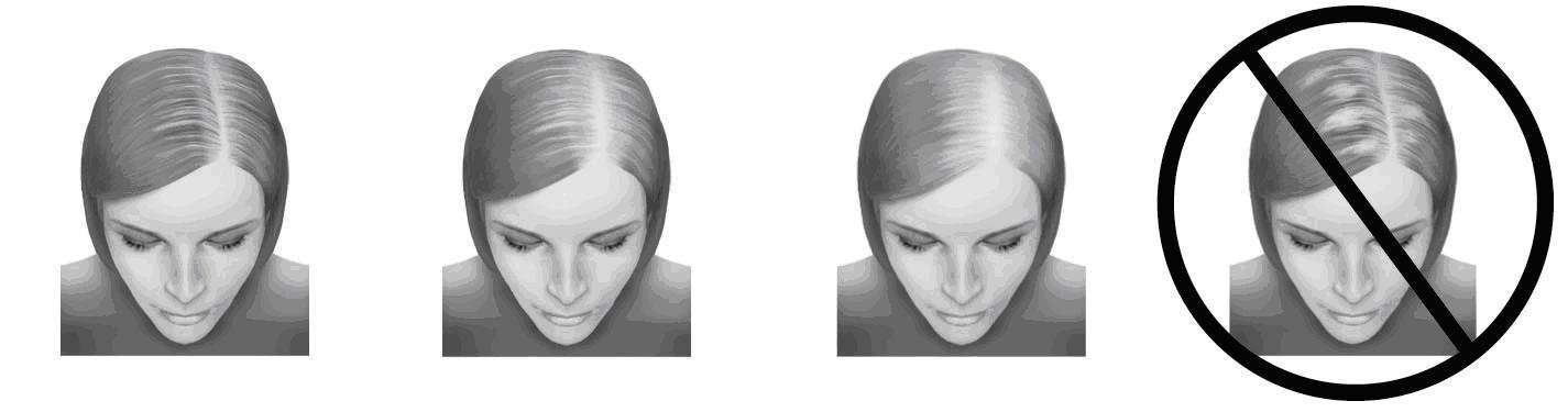 equaline hair regrowth treatment