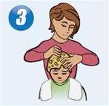 lice treatment