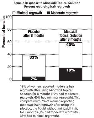 Hair Regrowth Treatment for Women