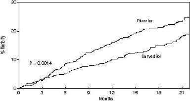 Carvedilol