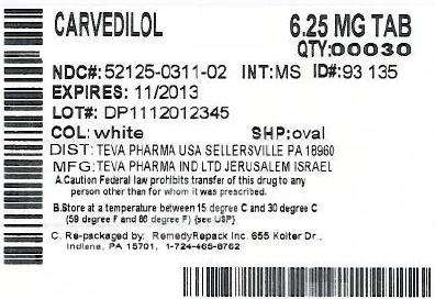 Carvedilol