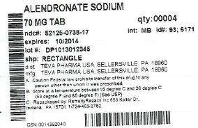 Alendronate Sodium