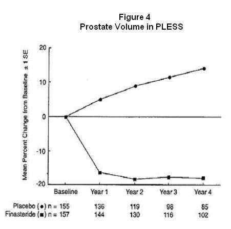 Finasteride