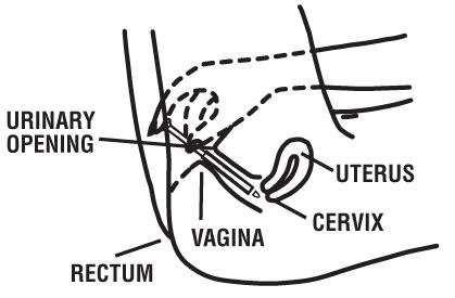 healthy accents miconazole 3