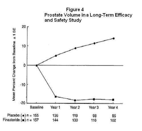 Finasteride