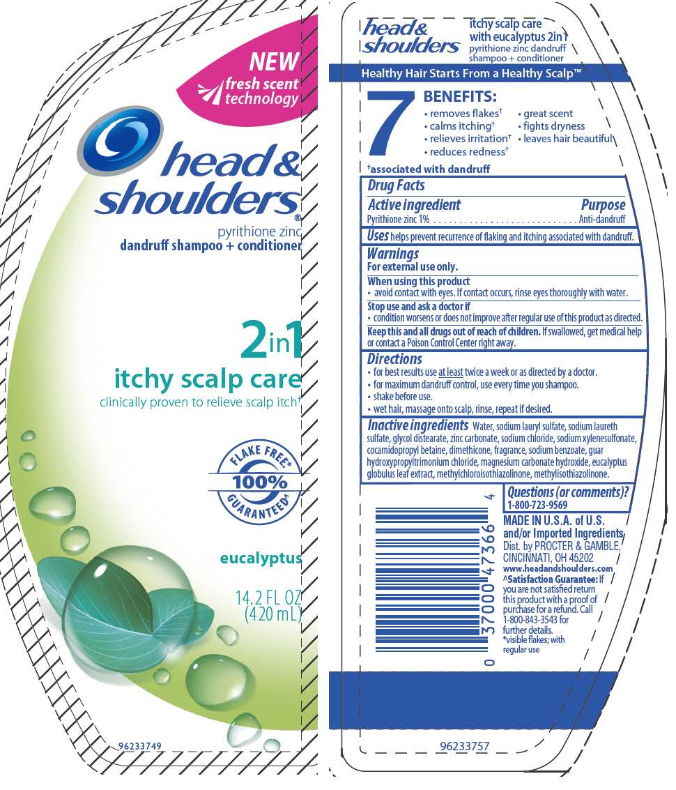 Head and Shoulders