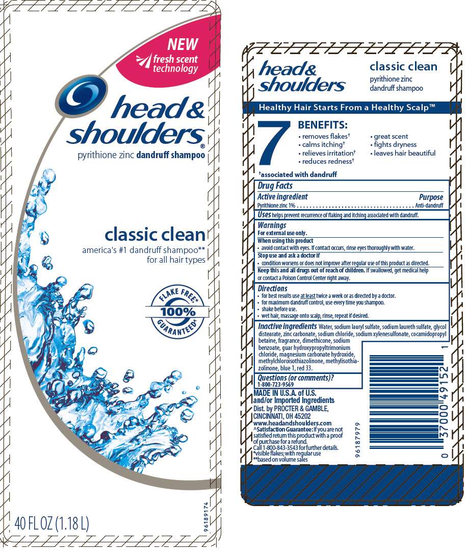 Head and Shoulders