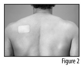 FENTANYL TRANSDERMAL SYSTEM