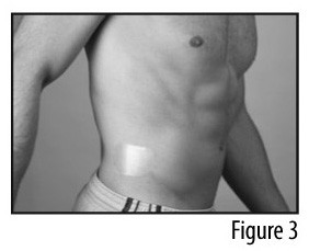 FENTANYL TRANSDERMAL SYSTEM