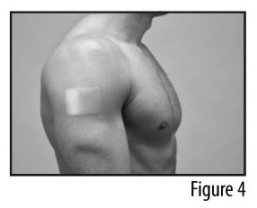 FENTANYL TRANSDERMAL SYSTEM