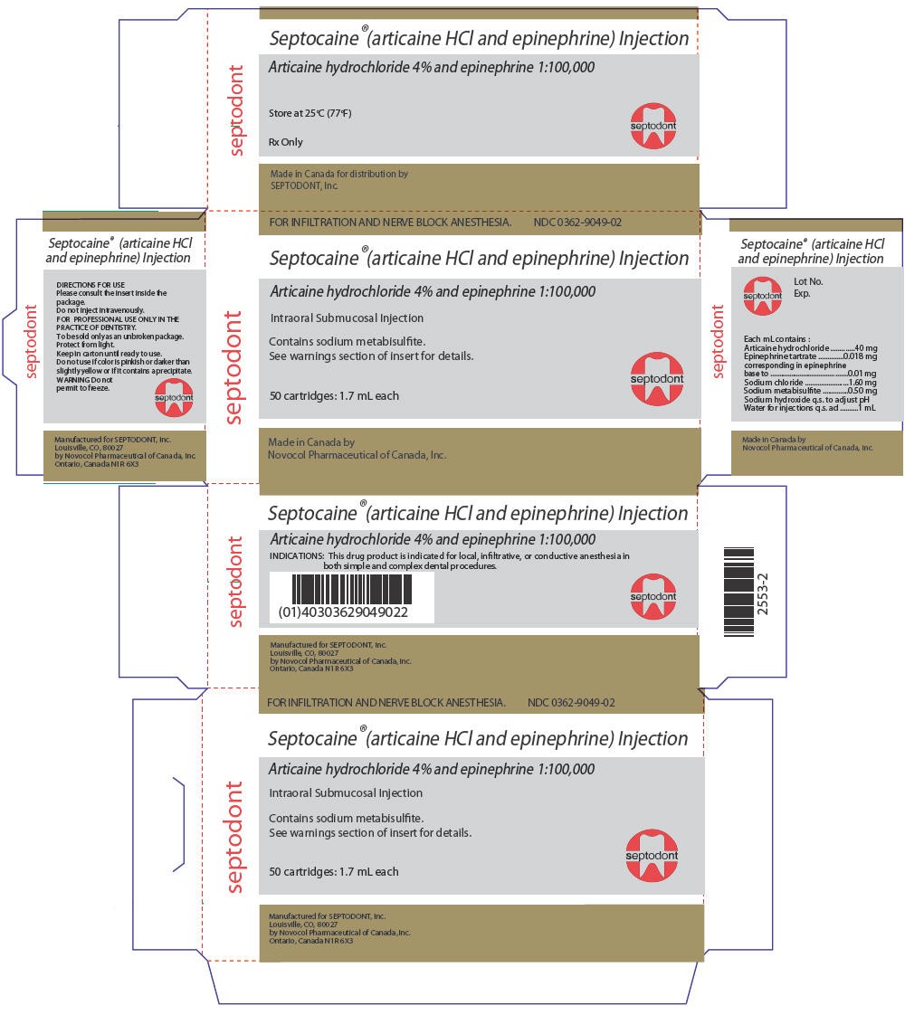 Septocaine and Epinephrine