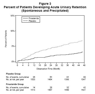 Finasteride