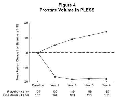 Finasteride