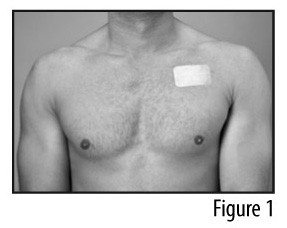 FENTANYL TRANSDERMAL SYSTEM