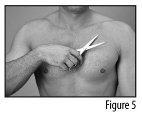 FENTANYL TRANSDERMAL SYSTEM